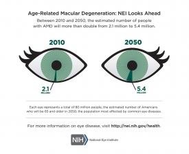 image tagged with statistics, eyes, information, age-related macular degeneration, eye, …;