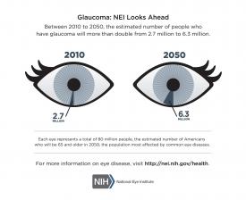 image tagged with health, statistics, glaucoma, infographic, eyes, …;