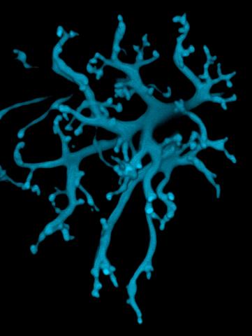 image tagged with anatomy, dendrites, microscopic, eye, nerve cells, …;