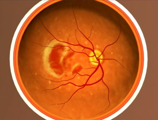 image tagged with age-related macular degeneration, microscopic, anatomy, science, vision, …;