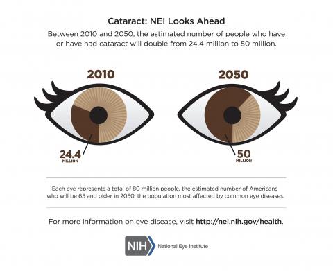 image tagged with health, cataracts, eyes, cataract, infographic, …;