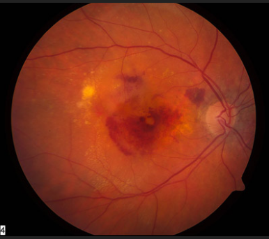 image tagged with science, eye, microscope, age-related macular degeneration, anatomy, …;