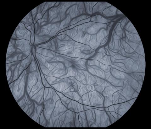image tagged with anatomy, science, ocular albinism, microscopic, retina, …;