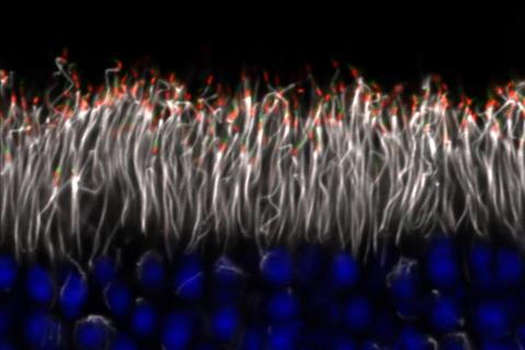 image tagged with fluorescent labeling, cilia, cilium, vision, anatomy, …;