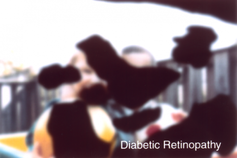 image tagged with eye, disease, simulation, diabetic eye disease, vision, …;