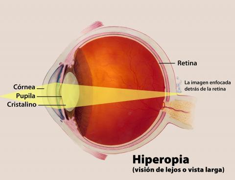 image tagged with vision, retina, diagram, cornea, visual, …;