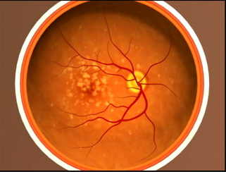 image tagged with microscope, age-related macular degeneration, vision, eye, anatomy, …;