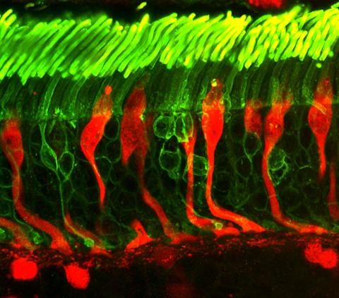 image tagged with nerves, confocal microscopy, rods, anatomy, cones, …;