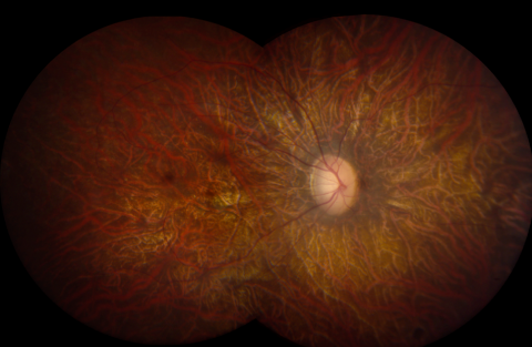 image tagged with eye, microscopic, eye disease, research, retinal disease, …;