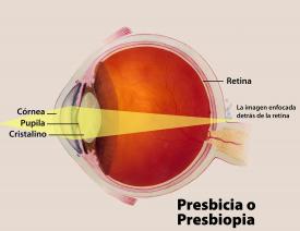 image tagged with vision, infographic, labels, anatomy, farsightedness, …;