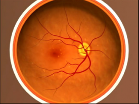 image tagged with vision, eye diagram, anatomy, age-related macular degeneration, microscope, …;