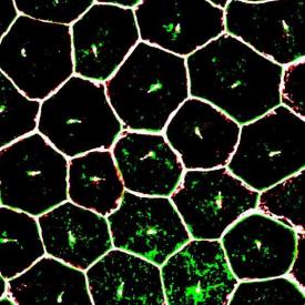 image tagged with primary cilia, microscopic, eye, retina, photoreceptors, …;