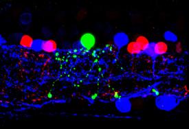 image tagged with neurotransmitters, eye, amacrine cells, anatomy, microscopic, …;