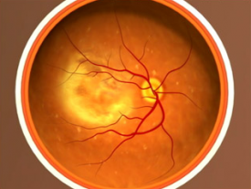 image tagged with microscopic, microscope, age-related macular degeneration, vision, science, …;