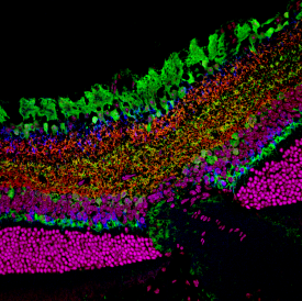 image tagged with nuclei, confocal microscopy, synapsin, bipolar cells, optic nerve, …;