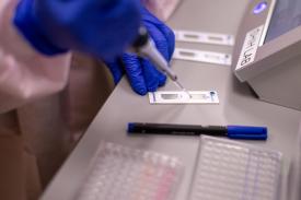image tagged with pipet, lab, research, pipette
