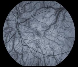 image tagged with retina, eye, vision, science, microscopic, …;