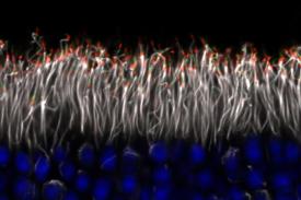 image tagged with cilia, retinitis pigmentosa, nerve cells, retina, vision, …;