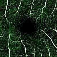 image tagged with blood vessels, fluorescein angiography, microscope, microscopic, cells, …;
