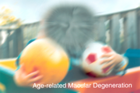 image tagged with age-related macular degeneration, ball, simulation, amd, disease, …;