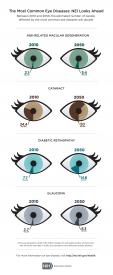image tagged with information, diabetic eye disease, infographic, amd, statistics, …;