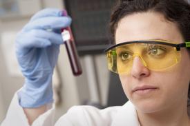 image tagged with lab coat, goggles, vision, sample, gloves, …;