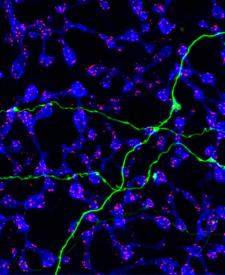 image tagged with amacrine, microscopic, amacrine cells, nerve cells, anatomy, …;