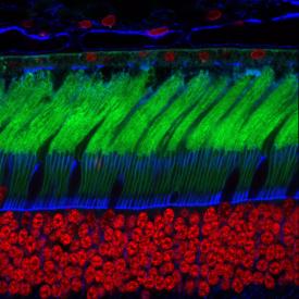 image tagged with science, retina, microscopic, photoreceptor cells, muller glia cells, …;