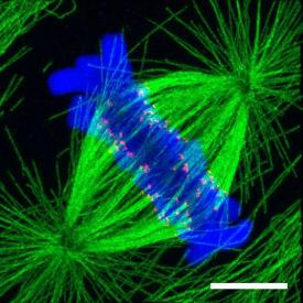 image tagged with dna, microscope, cell division, microscopic, microtubules, …;